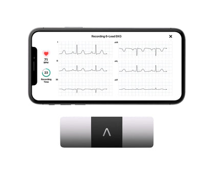 2026 KardiaMobile 6L Persönlicher EKG-Monitor für Smartphones
