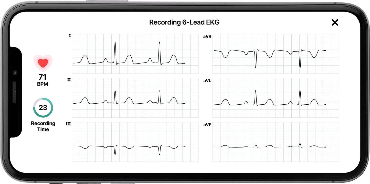 2026 KardiaMobile 6L Persönlicher EKG-Monitor für Smartphones