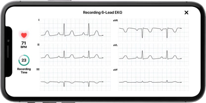 2026 KardiaMobile 6L Persönlicher EKG-Monitor für Smartphones