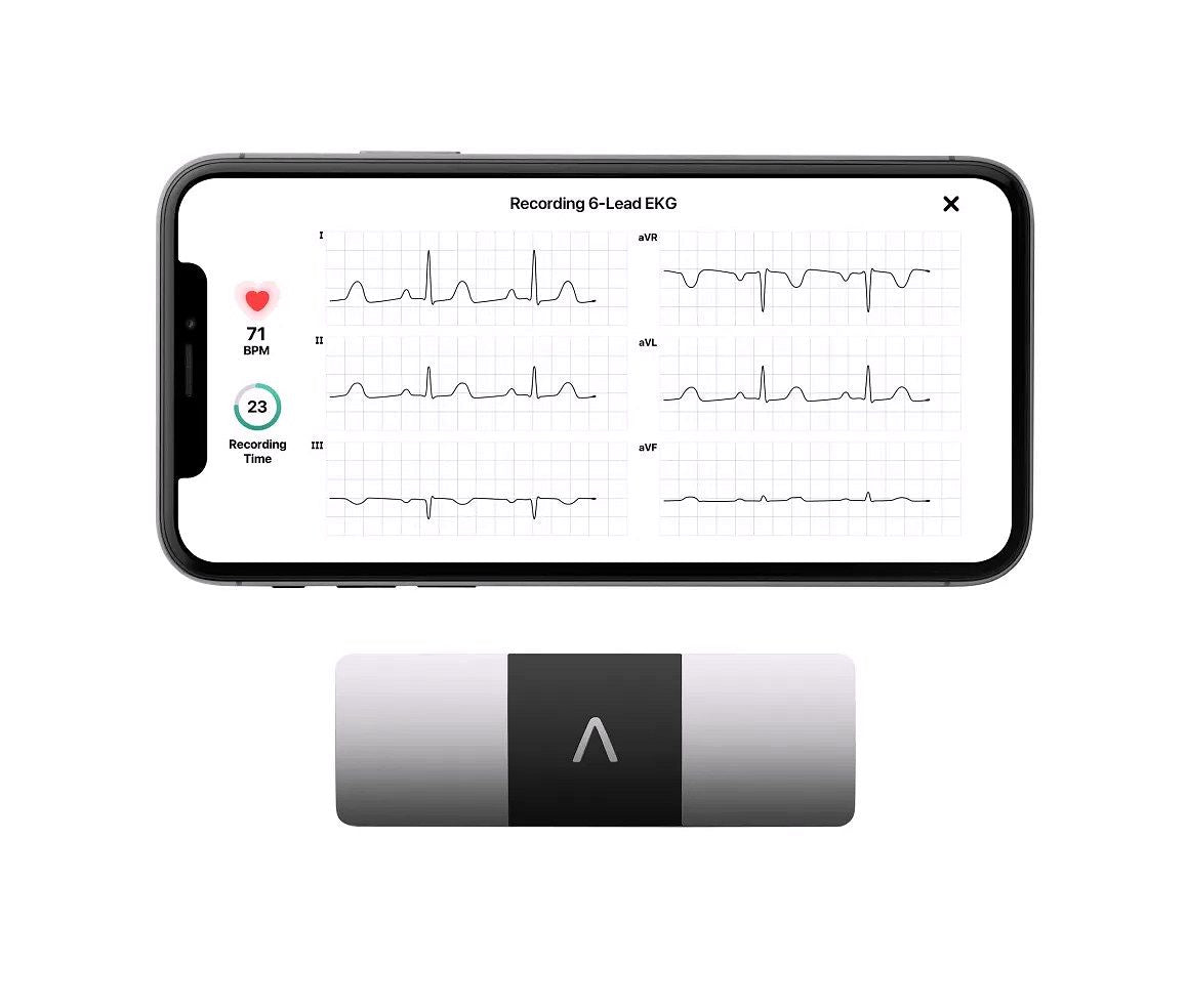 2026 KardiaMobile 6L Persönlicher EKG-Monitor für Smartphones