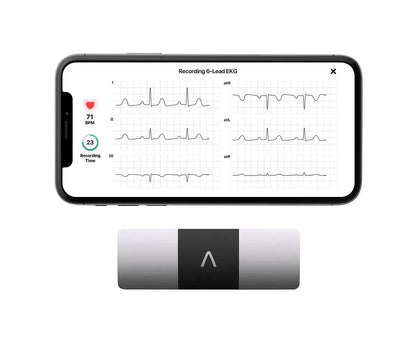 2026 KardiaMobile 6L Persönlicher EKG-Monitor für Smartphones